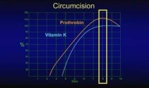 MEDICINSKO ČUDO OBREZANJA OSMOGA DANA